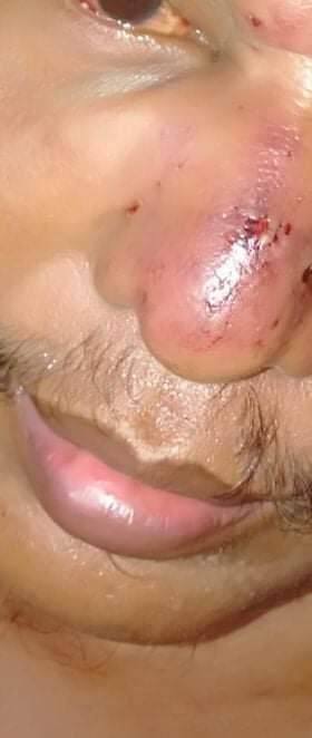 2021Revtweets's tweet photo. Tw // blood
In BanBwe village, Yinmapin, Sagaing region,Terrorists beaten Ko MyoNaing, an unhealthy man, destroyed his properties &amp; confiscated his phone. At least 5 houses were raided&amp;destroyed by Terrorists.
#Aug9Coup
#WhatsHappeningInMyanmar https://t.co/F7hUEDl4sX
