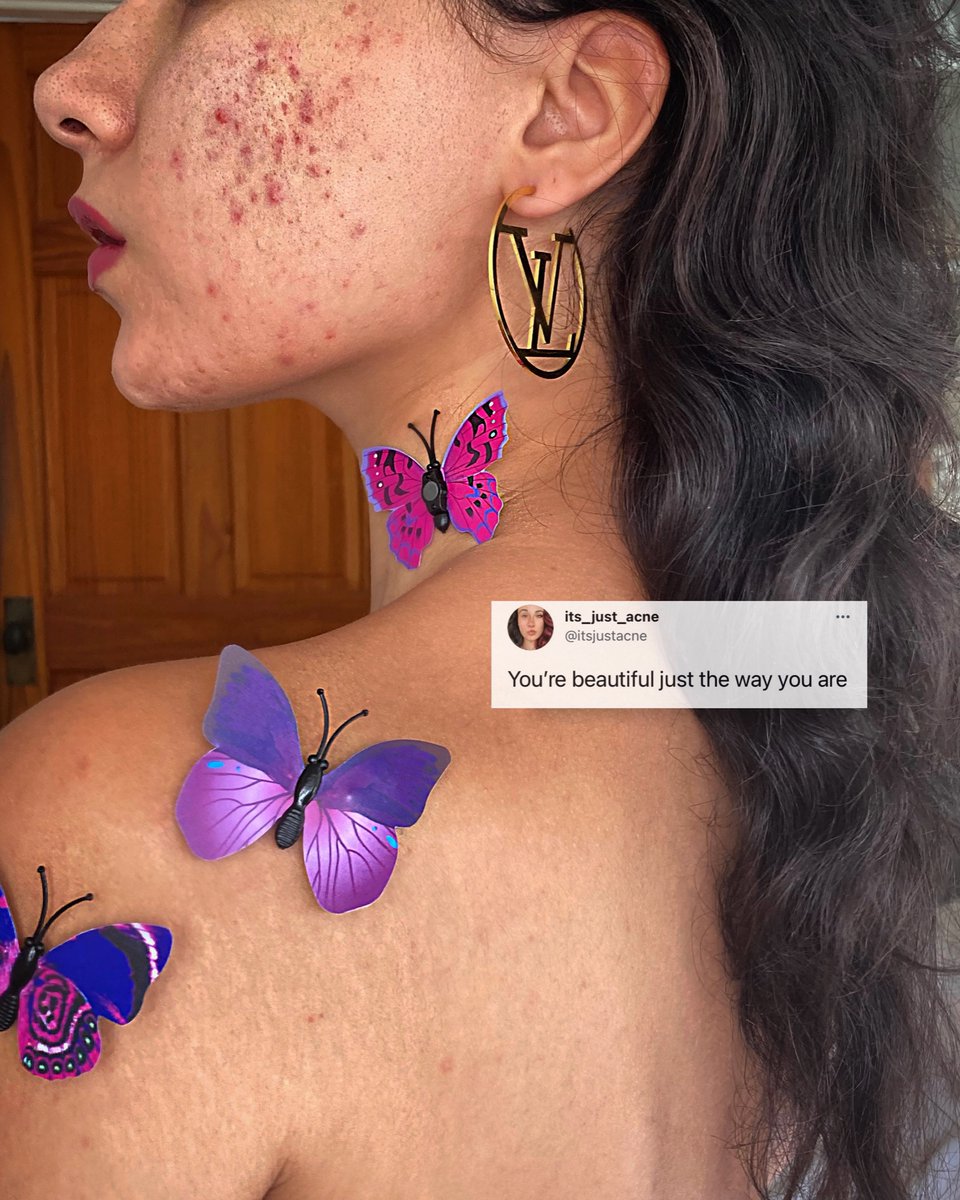 itsjustacne's tweet photo. Daily reminder:
#skinpositivity #bodypositivity https://t.co/j9vBFrbiKF