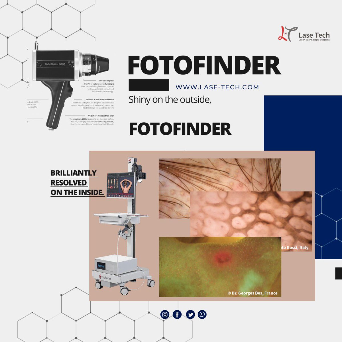 laseTechsystems's tweet image. Fotofinder:

-Shiny on the outside.
-Brilliantly resolved on the inside. -The black body of the medicam 1000s is made of high quality, anodized aluminum.
-This material is lightweight, durable and elegant.

Lase-tech.com

#FotoFinder #FotoFinderSystems #LaseTech #dubai
