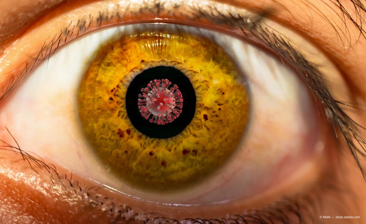 Are the first signs of #COVID19 seen in the #retina? New research investigates:
buff.ly/3rsdDKD

#Ophthalmology #Coronavirus #Research #COVID <a href="/snec_seri/">snec_seri</a>
