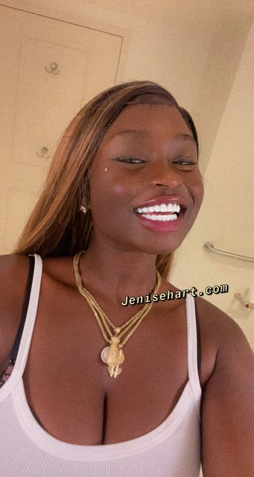 Got my perfect smile back! Fuck tongue piercings 😭❤️ https://t.co/0moJXH6E2m