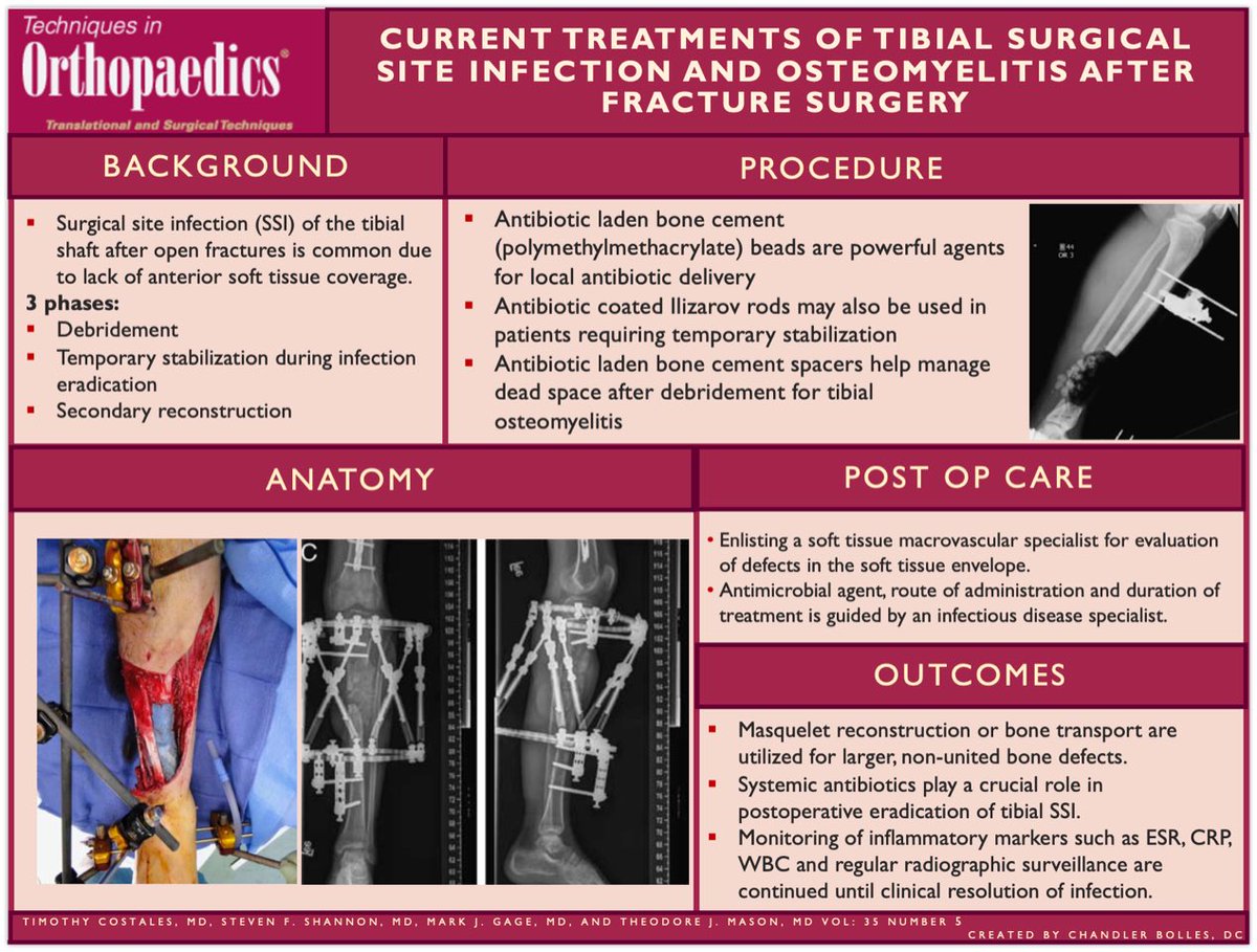 Our latest #VisualAbstract is out! "Current Treatments of Tibial Surgical Site Infection and Osteomyelitis After Fracture Surgery."

#Orthopedics #orthotwitter #orthopaedics #orthopedicsurgery