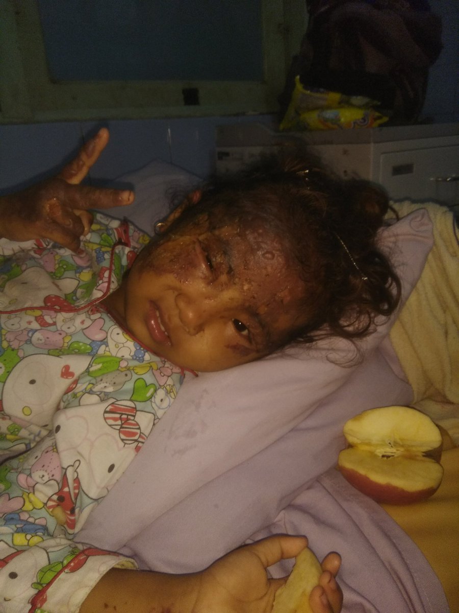 aryodafzi's tweet photo. Gus @na_dirs minta doanya, pagi ini putri saya jasmien, mau dioperasi, semoga berjalan lancar... https://t.co/dsy0TXpoUd