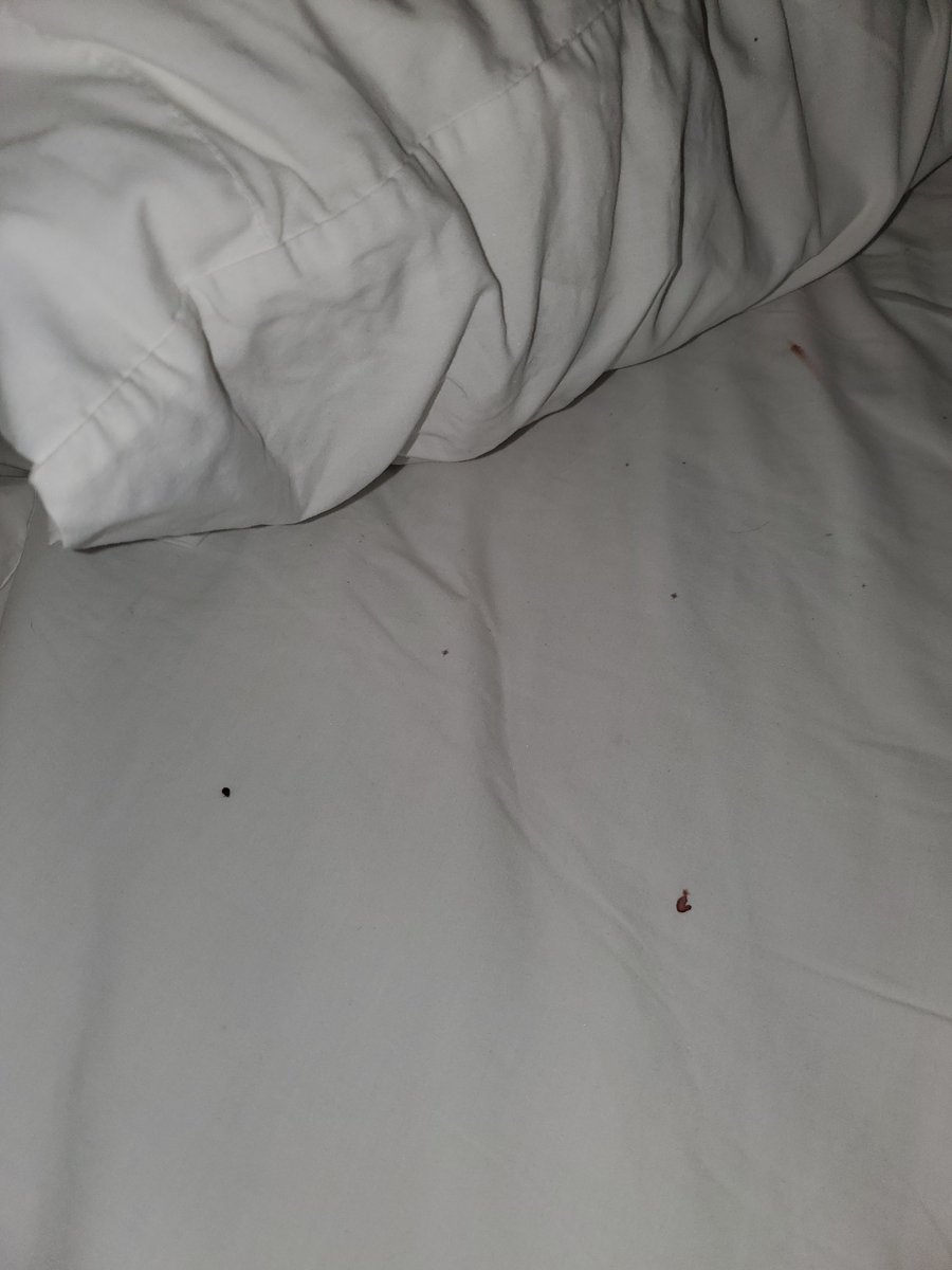 RVP4KG's tweet photo. Don't stay here, they have BED BUGS. We weren't there for even 9 hours, checked in at 11pm didn't go to sleep till about 2am. Woke up at 7am to find blood and BED BUGS all over the white sheets. It's been 2 days &amp; I still don't have a credit on my CC or apology @HolidayInnLPGA https://t.co/CiQ9LnpZKP