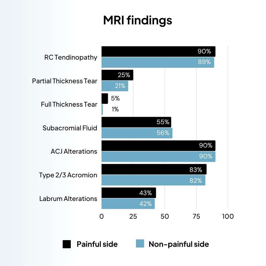 PhysioNetwork's tweet image. What happens when we take an MRI of both shoulders in someone with one-sided shoulder pain? 🤔

A study from 2019 looked at this 👀 

See what they found!

Does that mean that structure is not important? 

No, but it shows that pain is not just about structure! [thread]