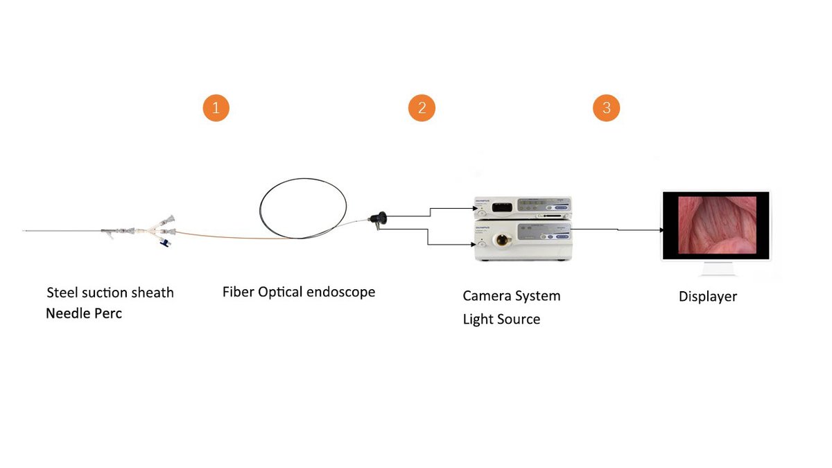 ElaineTong4's tweet photo. #RESISTONE
SeminalVesiculoscopy
Schematic diagram of 3.6/5.1Fr seminal Vesiculoscopy connection https://t.co/qmN2rqmCdm