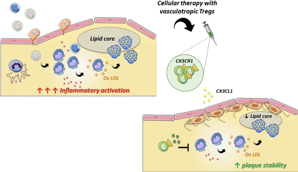 CVR_TomaszGuzik's tweet photo. EDITOR'S CHOICE: Adoptive cell therapy with CX3CR1 transduced Tregs selectively targets #immune activation in the atherosclerotic #plaque &amp; dampens #atherosclerosis progression
More here: https://t.co/mXl59yIJN5
@ESC_Journals @escardio #ACS #inflammation #CardiovascularResearch https://t.co/VlPzBBbF86