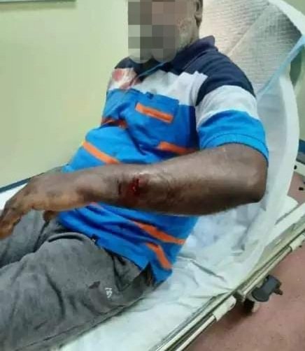 thanush_selva's tweet photo. A fried of mine who has been left behind in PNG was attacked by local mobs this evening. He was badly injured and was taken to hospital after 9 years this uncertain has not come to an end. PNG is not safe. https://t.co/FU3v4Ps8r5