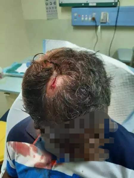 thanush_selva's tweet photo. A fried of mine who has been left behind in PNG was attacked by local mobs this evening. He was badly injured and was taken to hospital after 9 years this uncertain has not come to an end. PNG is not safe. https://t.co/FU3v4Ps8r5