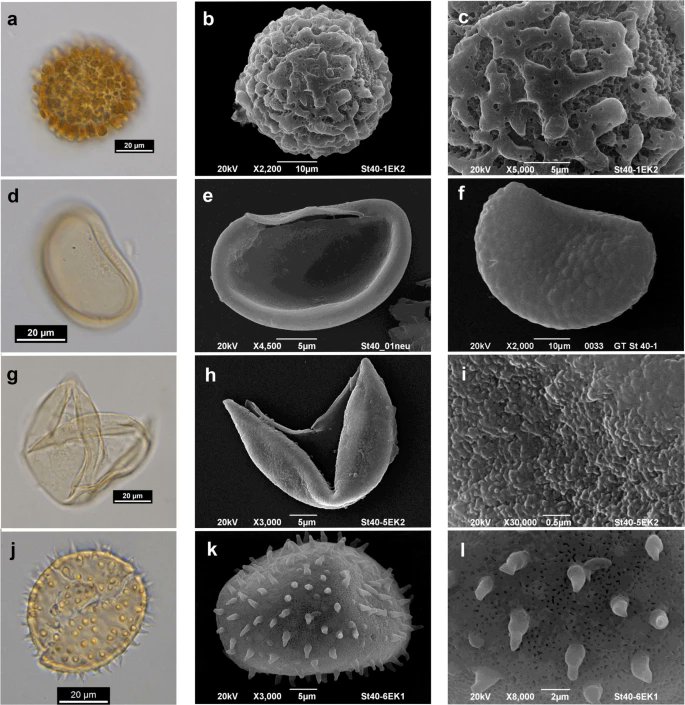 CGoisMarques's tweet photo. Wilde &amp; Riegel in press | A middle #Eocene treefall pit and its filling: a #microenvironmental study from the onset of a forest mire in the Geiseltal (#Germany) |  Palaeobiodiversity and Palaeoenvironments: https://t.co/T7RG1U36Pp
#Palaeobotany #palynology https://t.co/0ohj7TmPSi