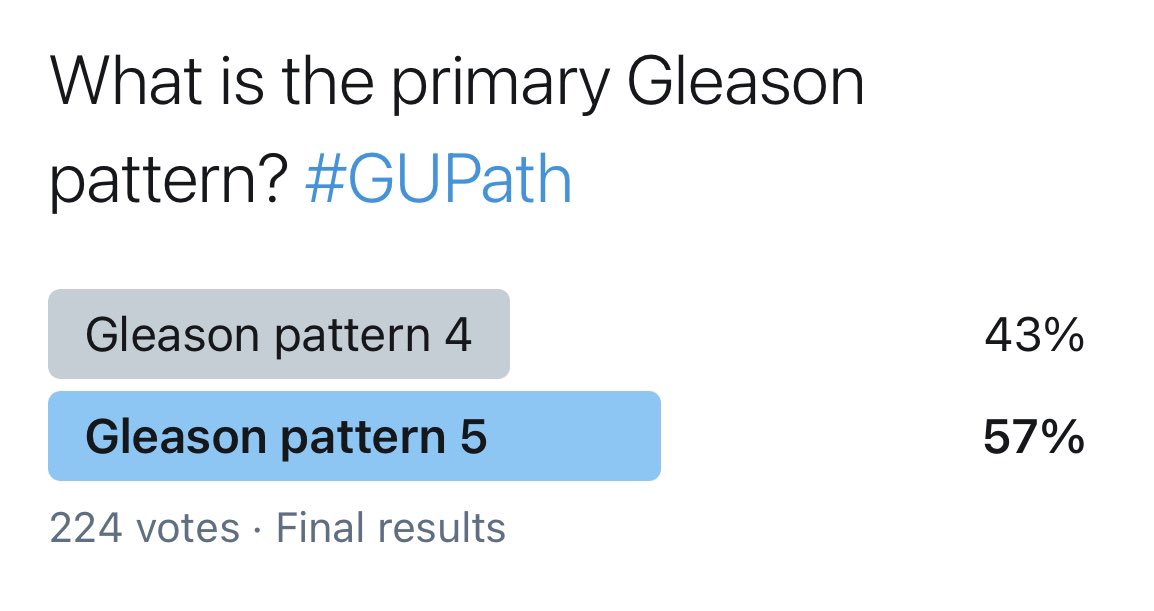 GladellPaner's tweet photo. Final poll: GP5 by 57% of 224 votes
As already commented, solid with rosette-like spaces was added to GP5 by 2014 ISUP.
I guess lack of clear spaces distinguishes this from GP4.
Thanks #GUPath tweeples for voting & informative comments! More #GradingChallenge cases to follow. https://t.co/N2xDLNu79f