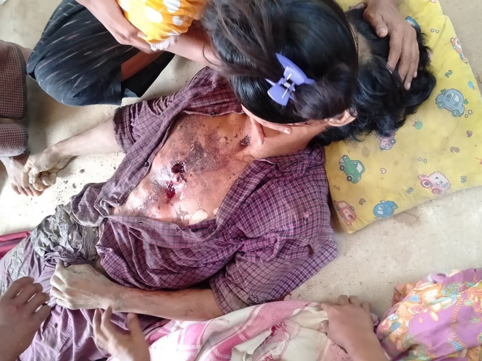 Myaing Township, Magway

INNOCENT MAN SHOT DEAD AT COVID_19 CHECKPOINT

Myaing has seen a series of demonstrations against SAC. SAC tried to find strike leader. When they were unsuccessful they arrested 4 people &amp; shot one man - Mg Aung Zeyar #WhatsHappeningInMyanmar 

Khit Thit