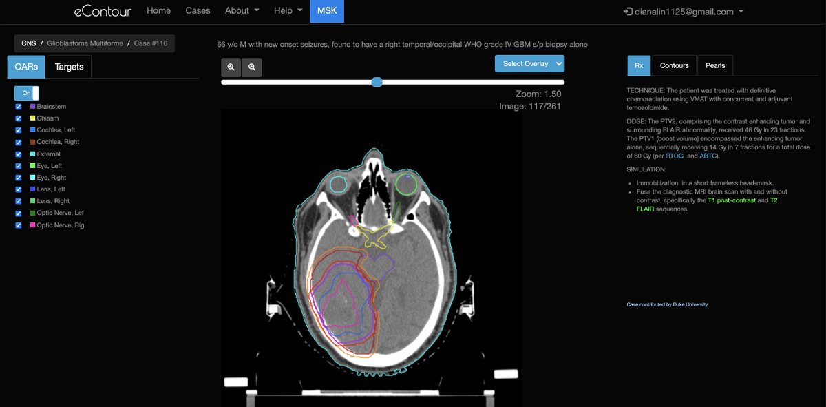 eContourRadOnc's tweet image. A big thank you 🙏 to the 🌟 #radonc residents who submitted our top 3 #econtour cases!

1⃣@JeremyPriceMD1 - GBM case 👉 staging.econtour.org/cases/116
2⃣@WaddleMd - Esophageal case 👉 staging.econtour.org/cases/60
3⃣@ChaurasiaMD - Rectal case 👉staging.econtour.org/cases/95