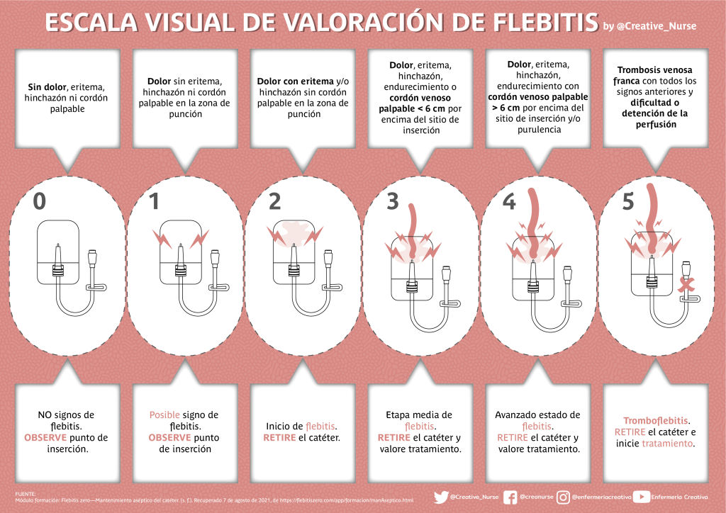 Creative_Nurse's tweet photo. Escala visual de valoración de #flebitis #infografia

https://t.co/YMzgQrEEZS https://t.co/mgj5igQGfx