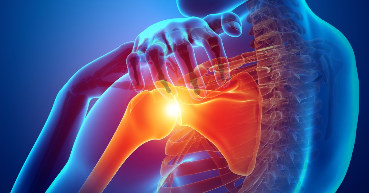 WebMD's tweet photo. You may know already that inflammation can cause sore joints. But it’s also linked to less obvious issues like balance problems, memory problems, rashes, and fatigue. https://t.co/Oz6N1GHmM2 https://t.co/fhDTu1OBbI