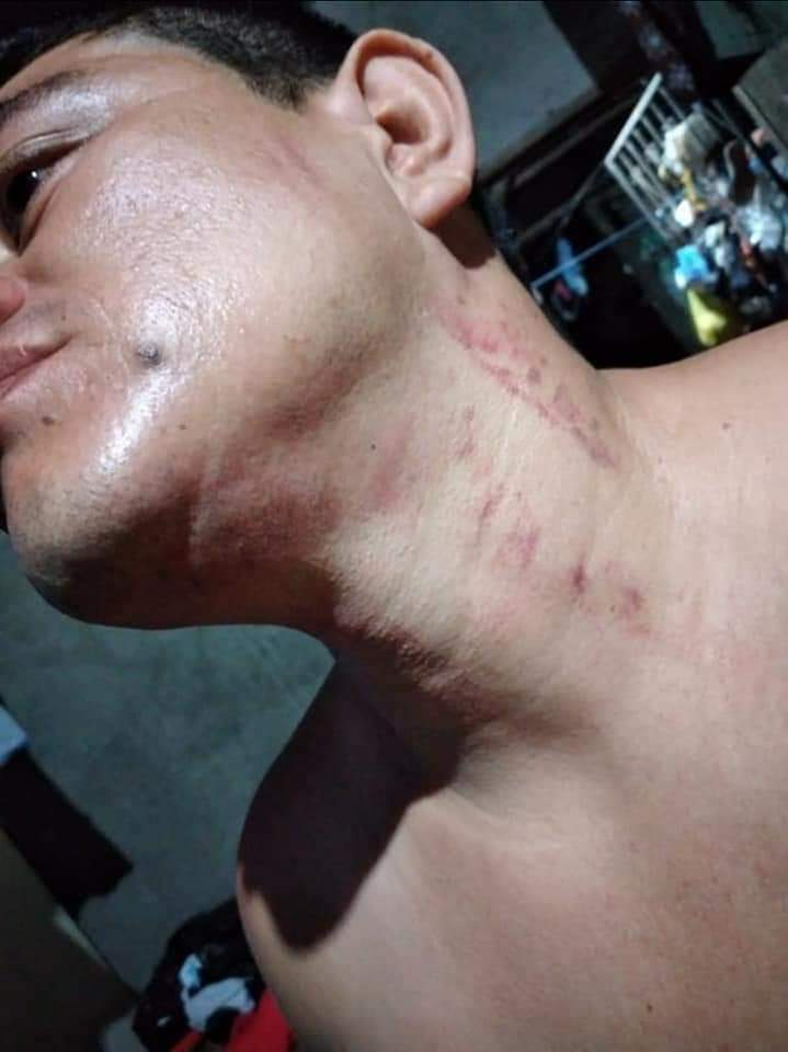 29Cheva_Patria's tweet photo. URGENTE 🆘

Excarcelado político Lenin Salasblanca, se entrega a las autoridades de migración de EEUU para solicitar asilo político.

Desde Nicaragua solicitamos a ese país que le abran las puertas. Lenin es de los ciudadanos que más represión política sufría. https://t.co/BJuO9Agw0W