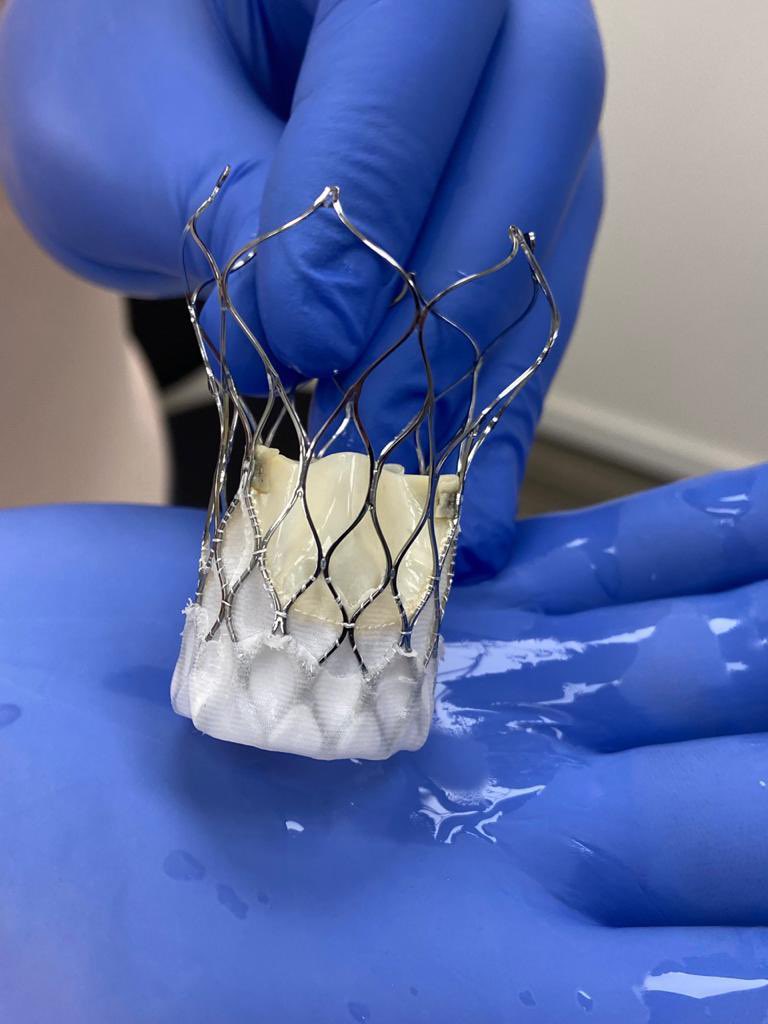 The first case TAVI VitaFlow I implant, Microport, was performed commercially outside of China in the department of Interventional Cardiology Diagnosis Mediter-Sanatorio Dr Julio Mendez in Argentina. Dr Matías Sztefjman as proctor, Dr Germán Cafaro (Director) Dr César Lopardo