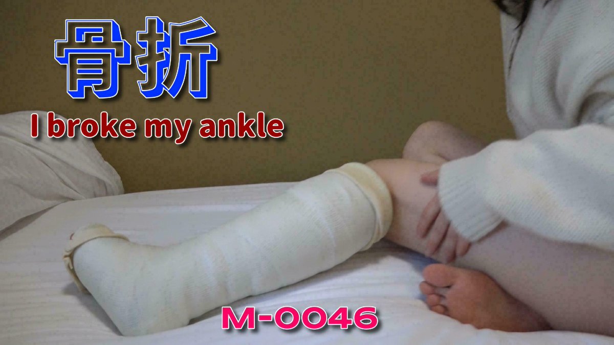 M-0046 リアギプRINA　骨折しちゃった youtu.be/mXXnB1a7NTY <a href="/YouTube/">YouTube</a>より