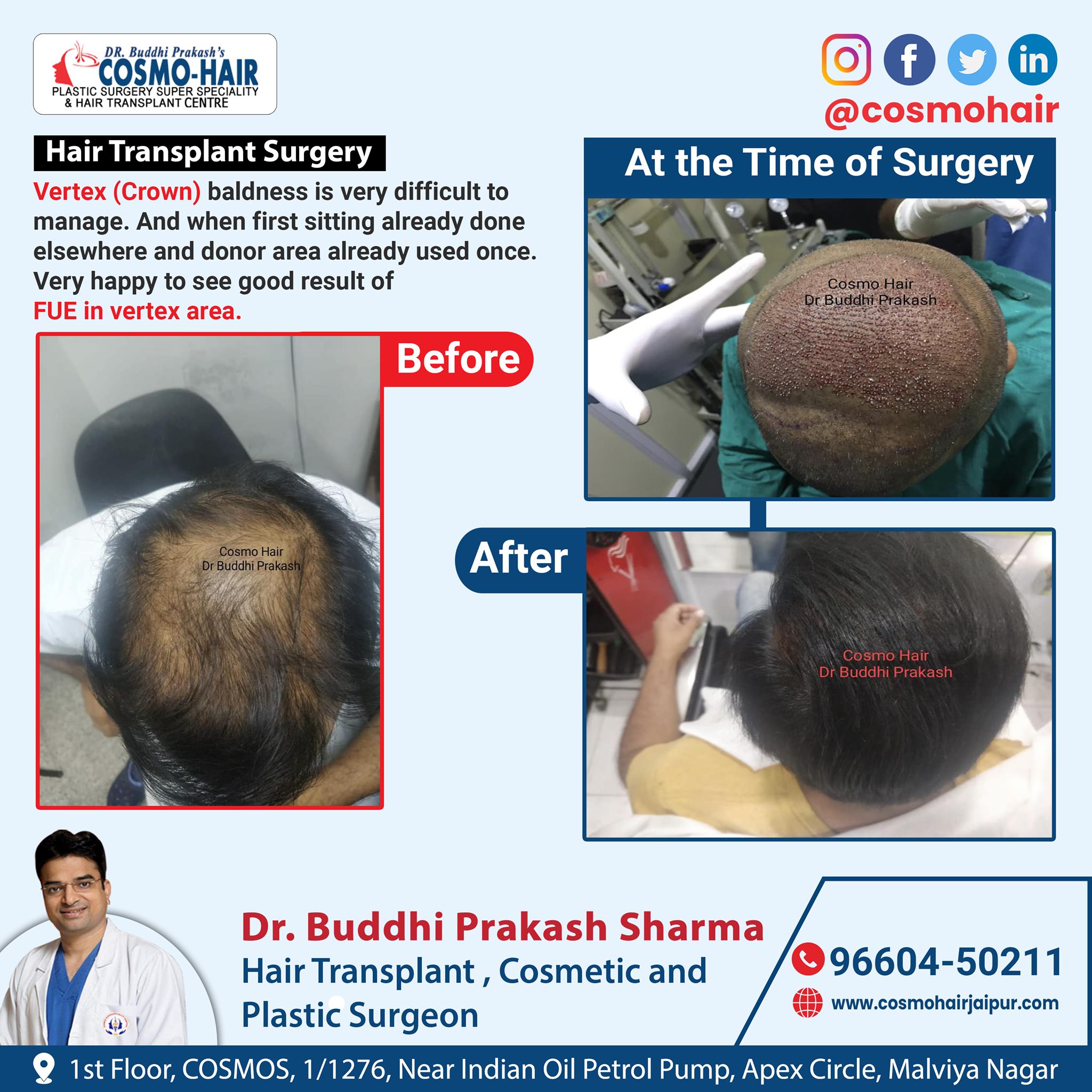 Twitter-এ Cosmo-Hair Jaipur: Twitter-এ Cosmo-Hair Jaipur: