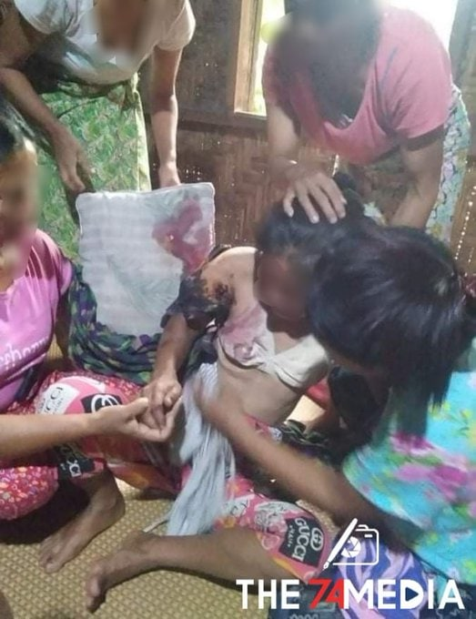 spring21MM's tweet photo. (1/2)
Tw\\ Wounds, Gunshots, Blood

At least FOUR people including two children were INJURED &amp; a 75-year-old man DIED of a Heart Attack and Many Houses were also DAMAGED due to Military terrorist troops continuously Shooting in #Minenaung Village, #Inndawgyi Area, ...

#Aug11Coup https://t.co/Cpj8dwom0v