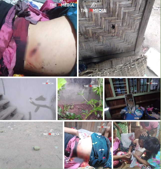 spring21MM's tweet photo. (1/2)
Tw\\ Wounds, Gunshots, Blood

At least FOUR people including two children were INJURED &amp; a 75-year-old man DIED of a Heart Attack and Many Houses were also DAMAGED due to Military terrorist troops continuously Shooting in #Minenaung Village, #Inndawgyi Area, ...

#Aug11Coup https://t.co/Cpj8dwom0v