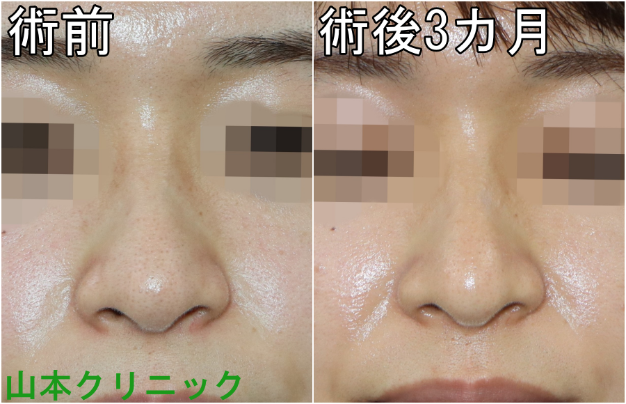 公式 山本クリニック 他院修正 Yamamotoclinic Twitter