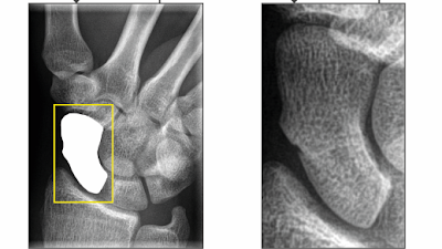 Radiology: Artificial Intelligence tweet media