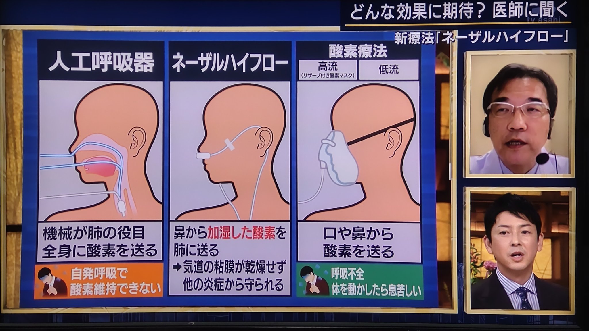 Twitter 上的 どすこいてじま 人工呼吸器のイラストと説明 肺の役目 Ecmoと混同 がかなり残念 ネーザルハイフローも 高流量の という肝心な部分が抜けているし ニュース番組なんだから 僕みたいな素人でも気付く間違いをしないで欲しいし 出演しているドクター