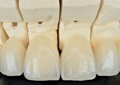HighEndDental's tweet photo. Have a case for us? Send in a request here: https://t.co/Oeyo4NhzaU

#HighEndDentalLab #HighEndDentists #DentalLabs https://t.co/VfVPw6N1eb