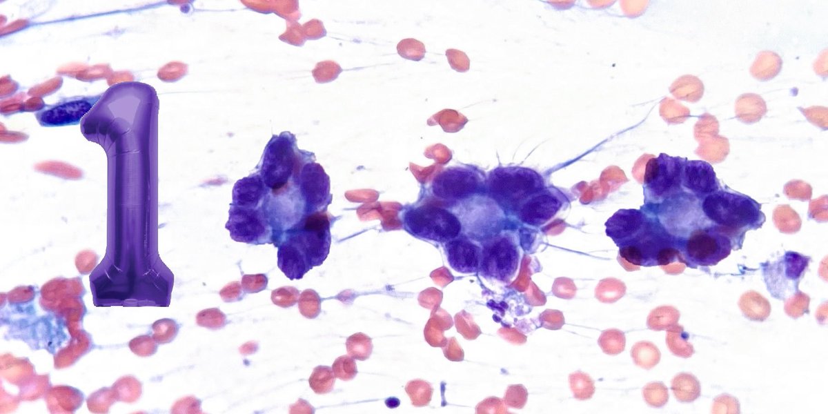 SECitologia's tweet image. ¡¡Estamos de Enhorabuena!!
 ¡Tenemos 1000 seguidores! 
🎆🙌🏼 🔬💜🔬🙌🏼🎆
¡1000 millones de GRACIAS!🙏🏼
 🥂Lo vamos a celebrar 🥂y ¡tendremos sorpresas!📸😉🔬 #Cytopath #1K #milgracias #SECteam