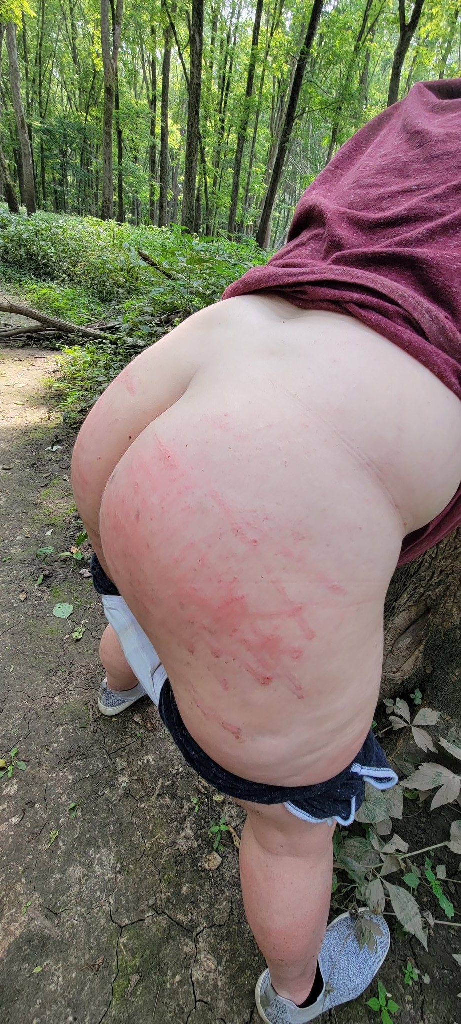 Sneak peak of my first spanking video and outdoor experience!!! Truly a thrilling and beautiful experience to have with my Master. 🥰☺️. Switches sting btw! 😅😝 https://t.co/jIX1QHPFdR
