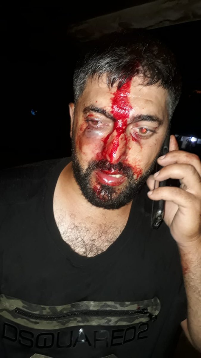 Marsadshaabi's tweet photo. مشاهد الاعتداءات على اهالي الضحايا والصحافيين أمام مقر عين التينة من بلطجية حرسه.البلطجة لا تدرك معنى الإنسانية تعتاش على حب الزعيم والتبعية له.صوت الحق سيظل يلاحق الضمائر الحية، ولن تُغلق قضية الأحبة، لن تُغلق قضية تفجير المرفأ الا بالقصاص منهم
#القرار_للشعب 
#نبيه_بري https://t.co/GVMi3TOTXg