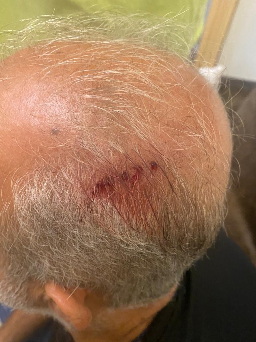 Marsadshaabi's tweet photo. مشاهد الاعتداءات على اهالي الضحايا والصحافيين أمام مقر عين التينة من بلطجية حرسه.البلطجة لا تدرك معنى الإنسانية تعتاش على حب الزعيم والتبعية له.صوت الحق سيظل يلاحق الضمائر الحية، ولن تُغلق قضية الأحبة، لن تُغلق قضية تفجير المرفأ الا بالقصاص منهم
#القرار_للشعب 
#نبيه_بري https://t.co/GVMi3TOTXg