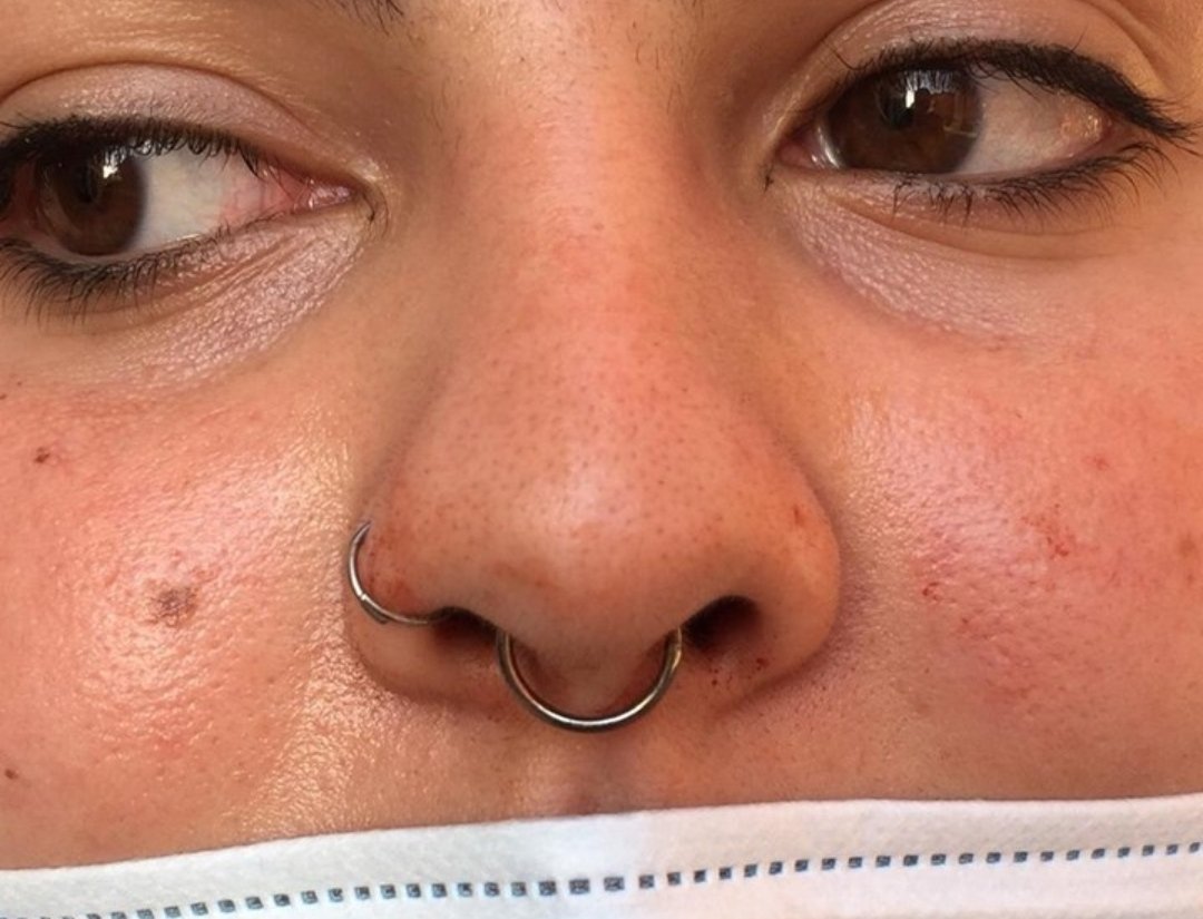 StudioDefiant's tweet photo. Septum piercing done by @runningawaypiercing!
DM for bookings and inquiries/Dm para marcações ou questões 
.

#defiantattoostudio #bodypiercer #runningawaypiercing #septumpiercing #septum #piercing #setubalpiercing #setubal #piercer #freehand #photooftheday #art https://t.co/wcjlSCXL8a