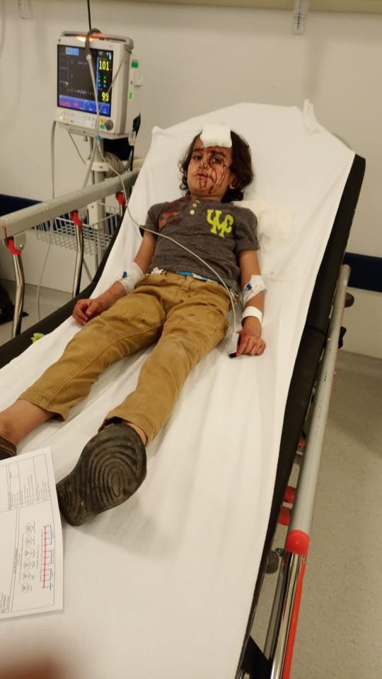 mehmet_dilbaz's tweet photo. İşin en acısı da şu:

Evi taşlanıp kafası yarılan şu çocuk bu ülkede doğdu. Suriye ile köken dışında bir bağı yok. Burada okula gidiyor, burada yaşıyor.

Kimin gazına gelip de çocuk döver olduk biz, yakışıyor mu bu necip millete? https://t.co/6TZNrj17Vt