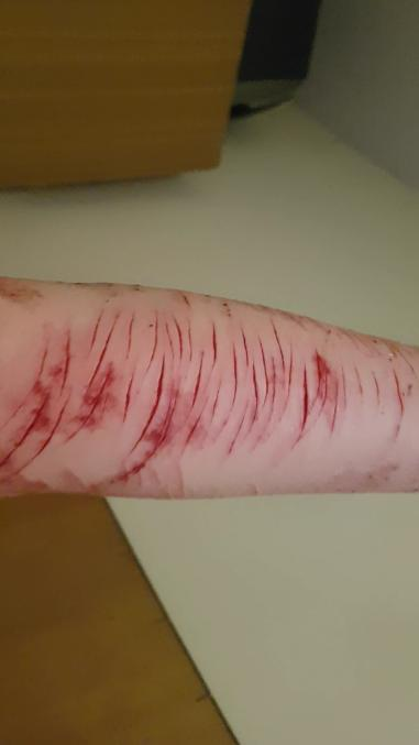 BeanFarmer5's tweet photo. Old pic || SHTWT very light styros, pic is almost 2 years old. || #selfharm #selfharmtwt #selfharmpics #shpics #shtwt #styrotwt #madeofstyro #styropics #sliceytwt #barcodetwt https://t.co/EdQddcSyOg