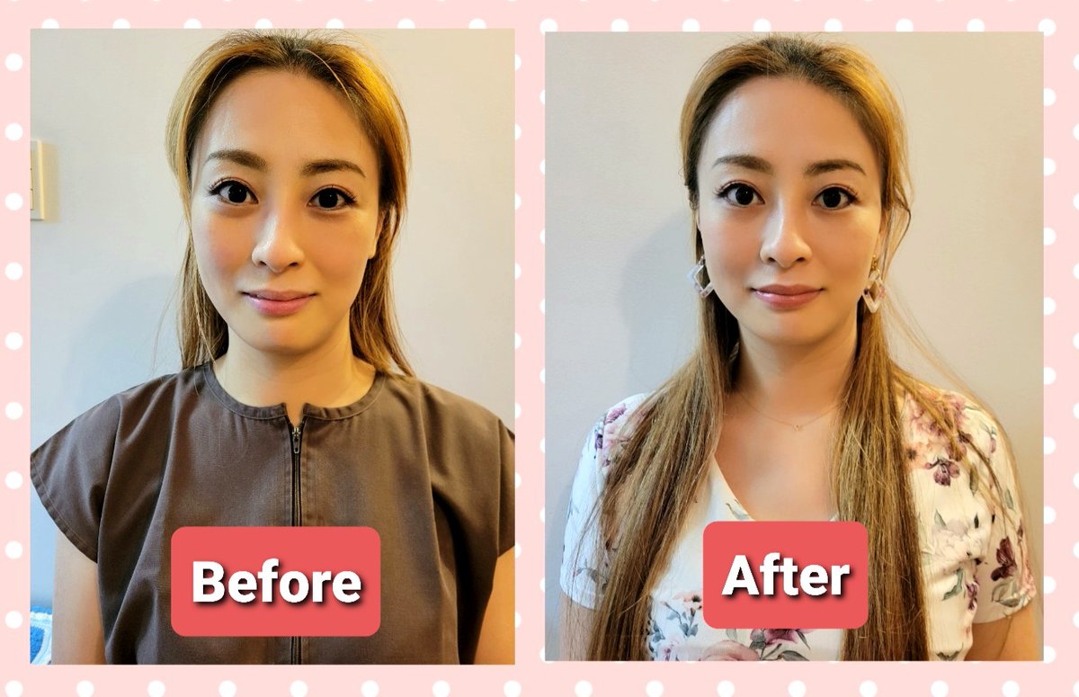 顎関節症 Twitter Search