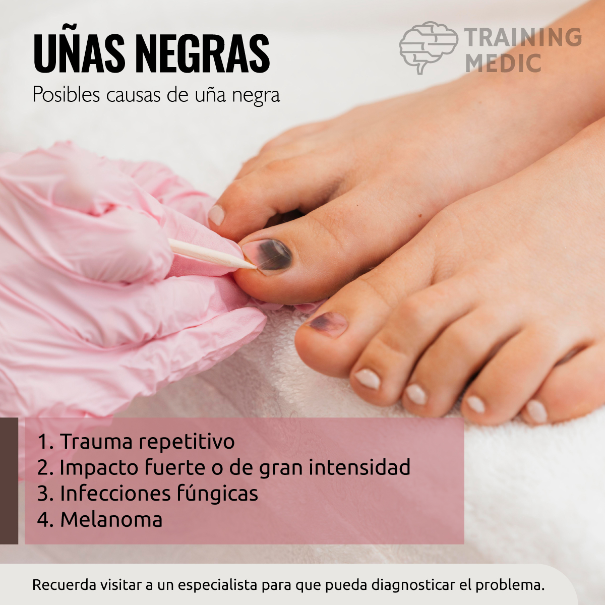 training_medic's tweet photo. Las uñas negras son un problema bastante común en el día a día y que se ha visto incrementado con el auge de los hábitos deportivos.

Algunas de las posibles causas.
1. Trauma repetitivo
2. Impacto fuerte o de gran intensidad
3. Infecciones fúngicas
4. Melanoma https://t.co/l8v9E5pU0v