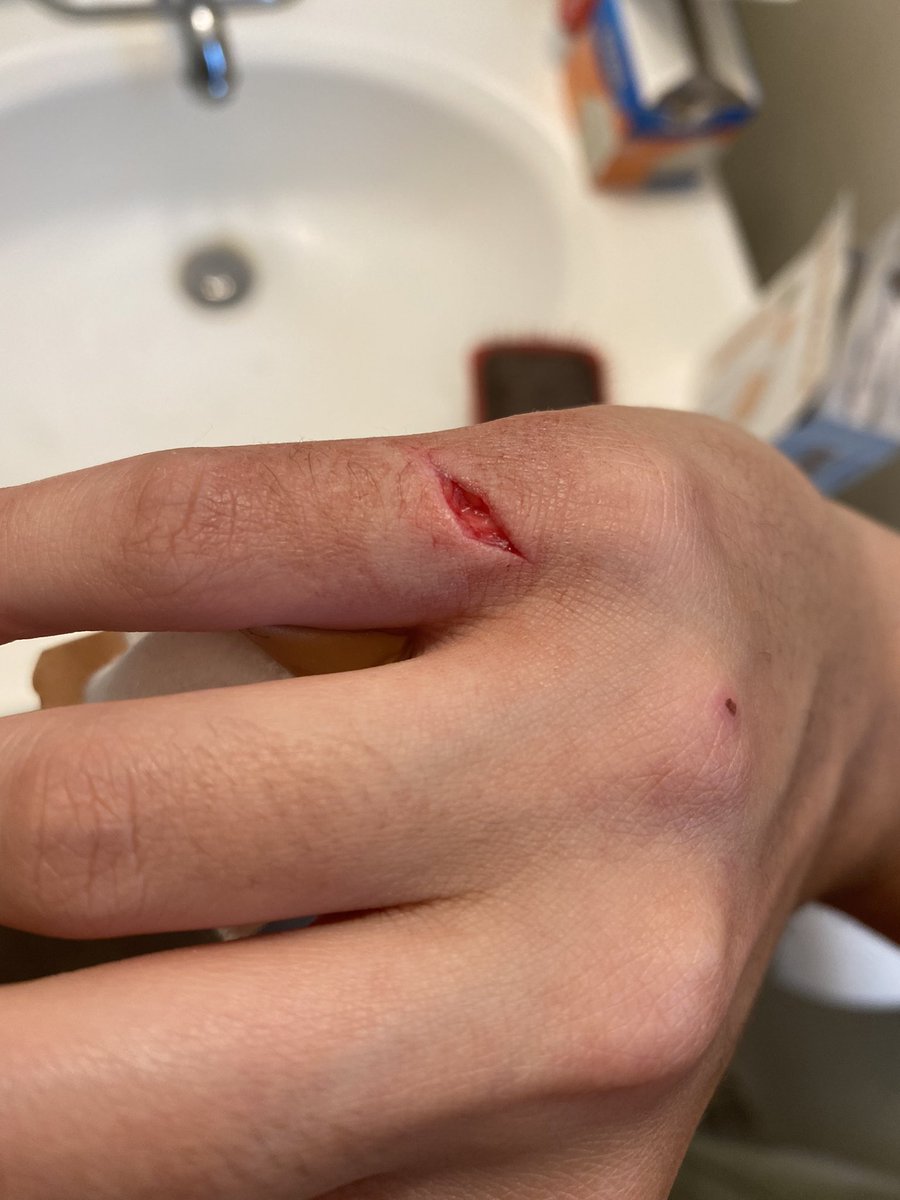 daffodil_daze_'s tweet photo. I really had to get stitches today because of a gnome coffee mug. This house wifin’ stuff is no joke. Stay safe out there ladies. https://t.co/oKgBOnNW3M