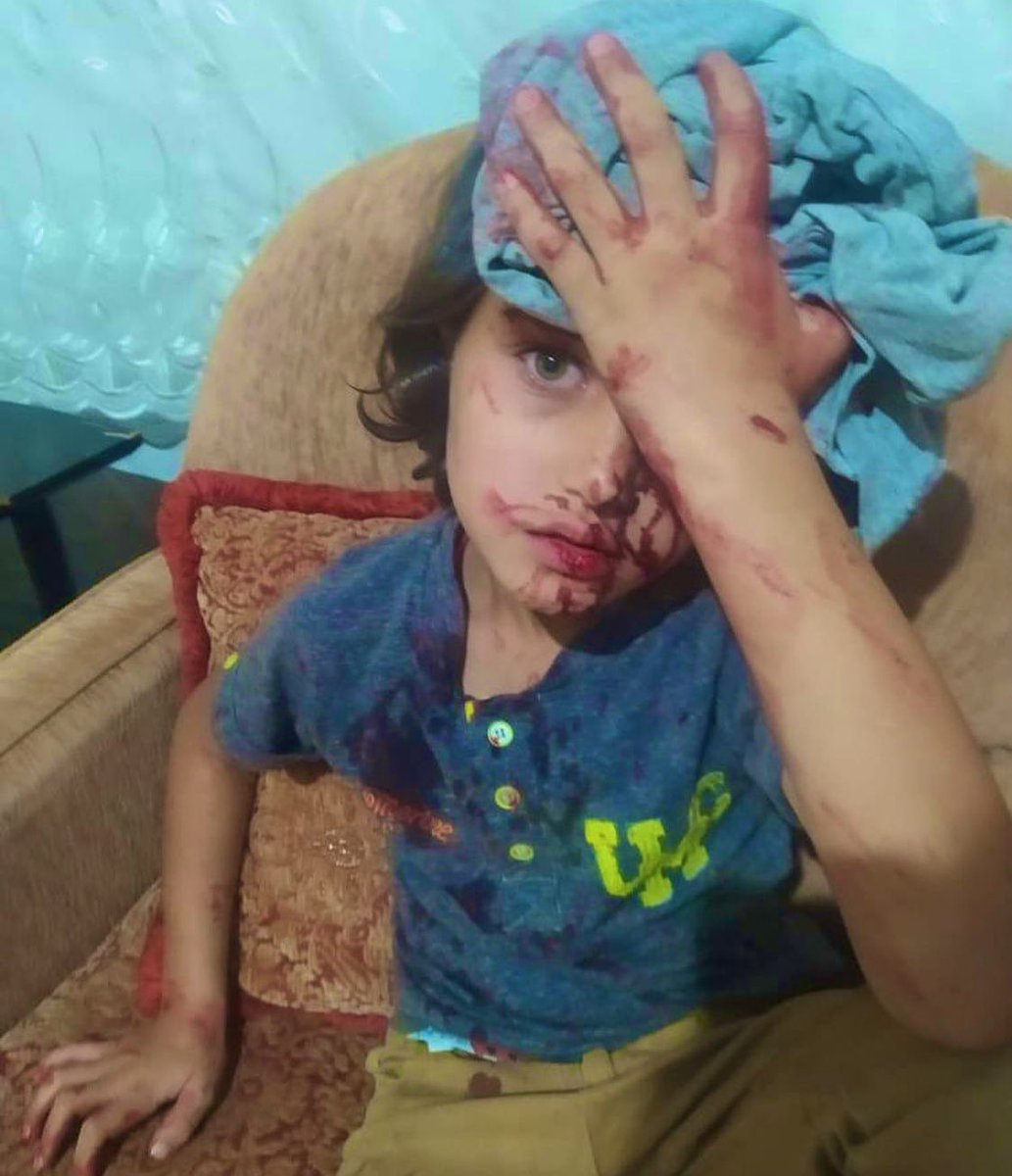 Ölüm döşeğindeki mazlum babaların çocuklarına “Sizi Allah’tan sonra Osmanlı’ya emanet ediyorum.”dediği bir milletin çocukları, nasıl olur da bir kişinin işlediği suçtan bütün Suriyelileri sorumlu tutar?!Çocuğu bu hale getirir?
Bu hal, MÜLKÜN sahibi Allah’ın(cc) gazabını celbeder.