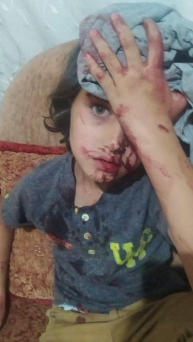 Mustafa82427030's tweet photo. Bu yavruya el kaldıran hayvan yavrusu sen insan değilsin kim olursan ol,bu mazluma bu zülmü laik gören zalimdir Esad’ın çocuğudur. https://t.co/uhKsLOfEbk
