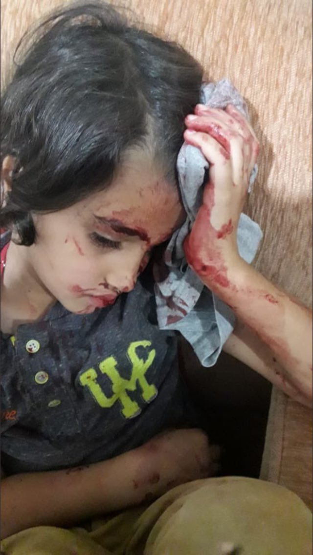 Mustafa82427030's tweet photo. Bu yavruya el kaldıran hayvan yavrusu sen insan değilsin kim olursan ol,bu mazluma bu zülmü laik gören zalimdir Esad’ın çocuğudur. https://t.co/uhKsLOfEbk