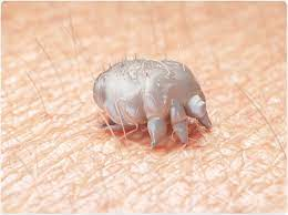 Running survey management #scabies Takes c.30 mins &amp; love hear from clinicians around world bit.ly/2TNVL04 NB repeated questions deliberate!