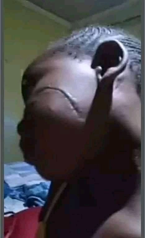 RKhubana's tweet photo. This is muofhe madadzhe. Daughter of @Sabclivhujokes. She has a scar after her own blood father feed her to dogs as a punishment.
 Sabc livhu is heartless😠😠😠😠😠

Retweet and make this trend 

#sabclivhumustfall #gbv #rain #Ramaphosa https://t.co/8k6N3LEFf0