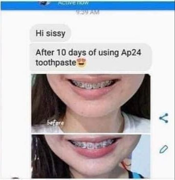laiiquinx's tweet image. Nakakatuwa talaga ang Whitening Toothpaste na to! Dami laging feedback!😍

Iba ka talaga #ap24whiteningfluoridetoothpaste!
Gusto mo din magpaputi ng ngipin? DM me📩

#nsph #LegitDistributor #oralcare #feedbackfromcustomer #satisfied