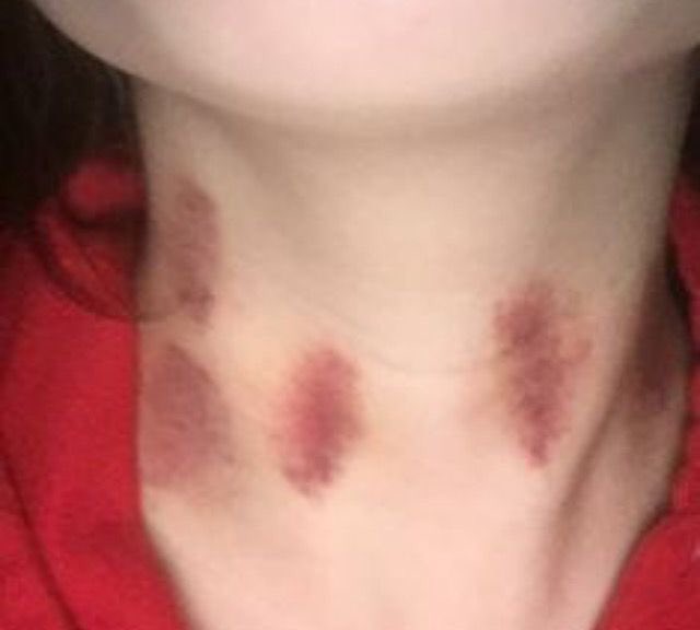 hhotthings's tweet photo. simple kissing https://t.co/ScohsK11mO