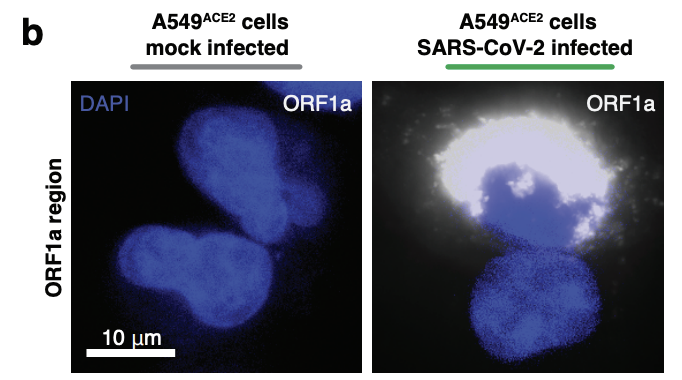 I am very excited to share the work of <a href="/kofi_acheampion/">Kofi Acheampong| MS4</a> and <a href="/DylanLSchaff/">Dylan Schaff</a> as well as the first pre-print from the lab!! 🥳 -- Multiplexed detection of SARS-CoV-2 genomic and subgenomic RNA using in situ hybridization
biorxiv.org/content/10.110…