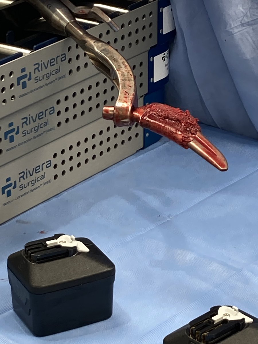 RiveraSurgical's tweet photo. What a great day for the patients! Results from three surgeries yesterday: 3  Minutes 23 Seconds, 3 minutes 56 seconds, and 19 minutes!
Watson Extraction System strikes again! https://t.co/EgsZUU7L7L