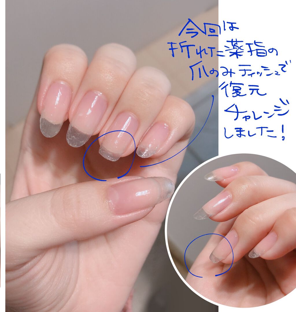 Lips リップス 爪が割れたときに ティッシュを使って爪を補強 する方法 オール100円アイテムで キャンドゥ硬化ライト セリアジェルネイル ティッシュ やすり 私は左手の薬指だけ欠けたのでティッシュで長さを出してみました Liii Lips リップス 爪が割れたときに ティッシュを使って爪を補強 する方法 オール100円アイテムで キャンドゥ硬化ライト セリアジェルネイル ティッシュ やすり 私は左手の薬指だけ欠けたのでティッシュで長さを出してみました Liii