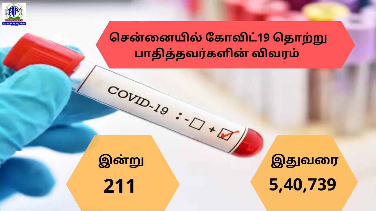 TamilNadu Covid-19 Daily Data Tracker: கடந்த 24 மணிநேரத்தில் 1,933 பேருக்கு கொரோனா பாதிப்பு, 34 பேர் உயிரிழப்பு